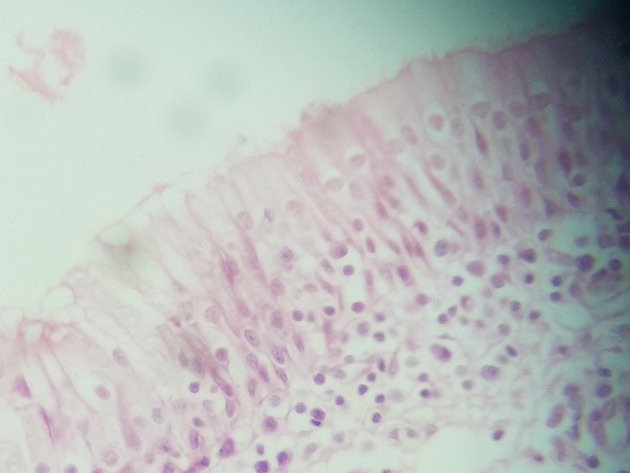 Pseudostratified Epithelium Slides - Pseudostratified Epithelium 04 400X